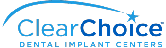 Clearchoice-Dental-Implants